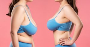 breasts sagging after weight loss